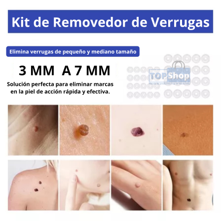 Removedor de Verrugas - Sking Tag