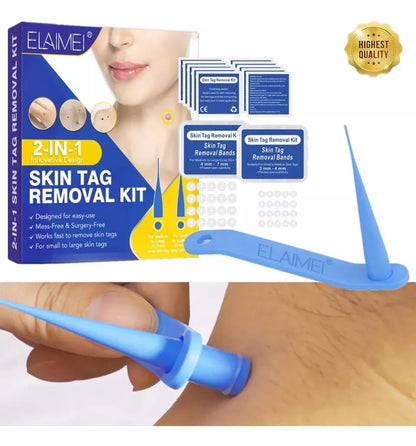 Removedor de Verrugas - Sking Tag