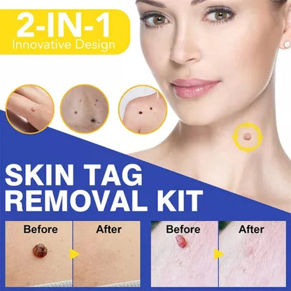 Removedor de Verrugas - Sking Tag