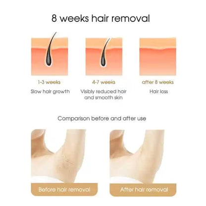 Depilador Laser Intense Pulsed Ligth