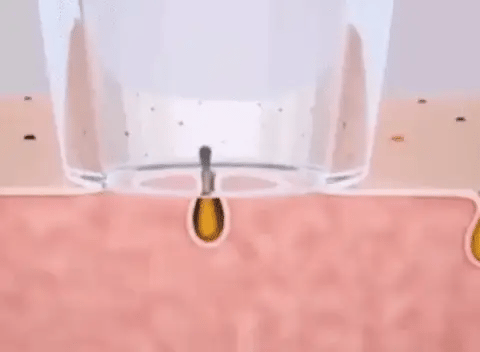 Limpiador Facial Inalámbrico