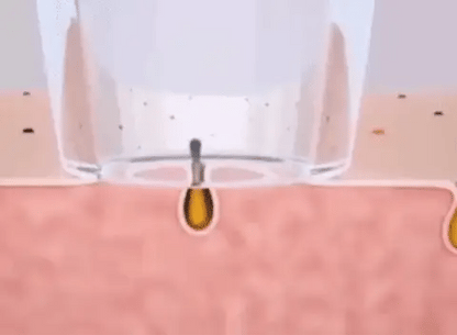 Limpiador Facial Inalámbrico